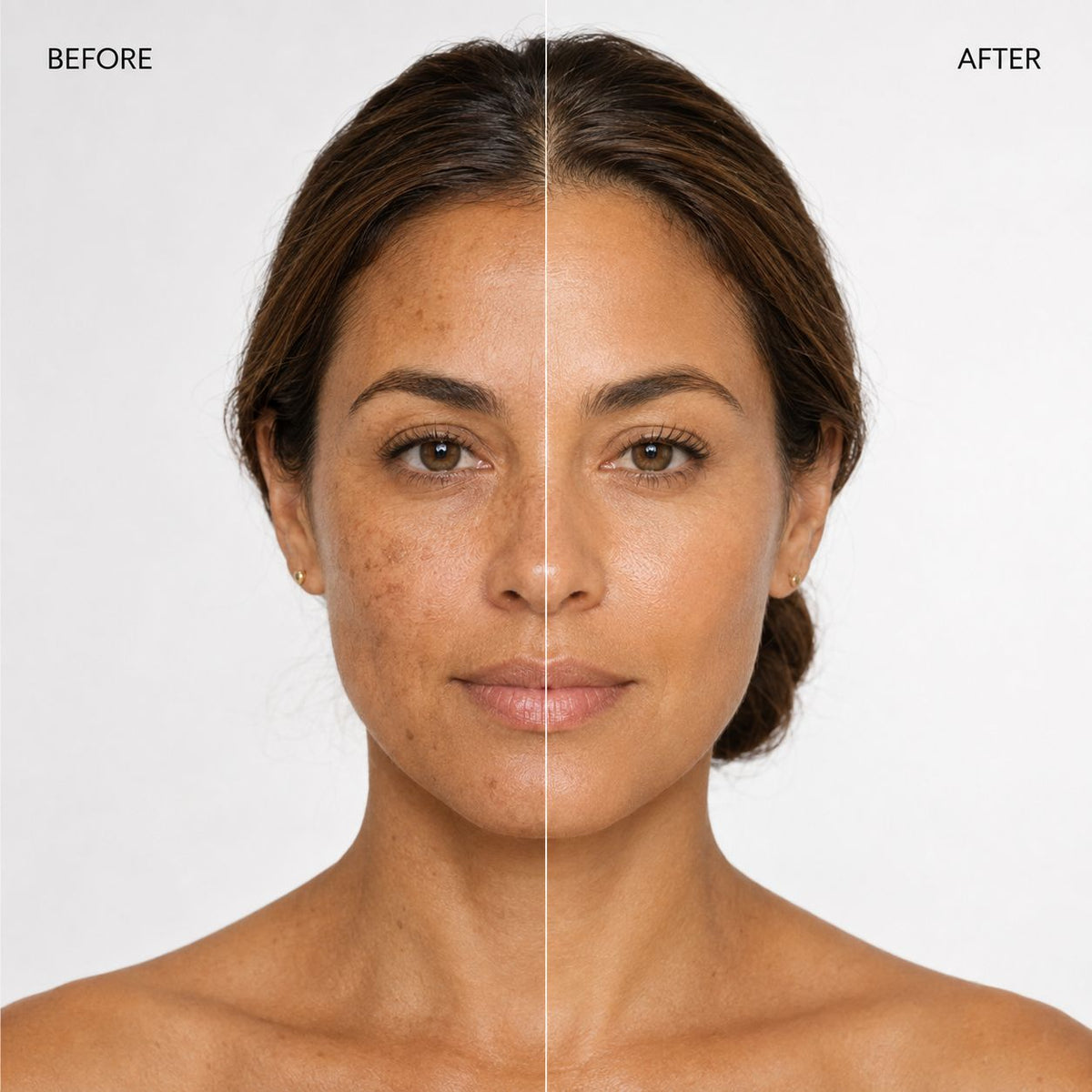 Dark Spot Corrector Cream